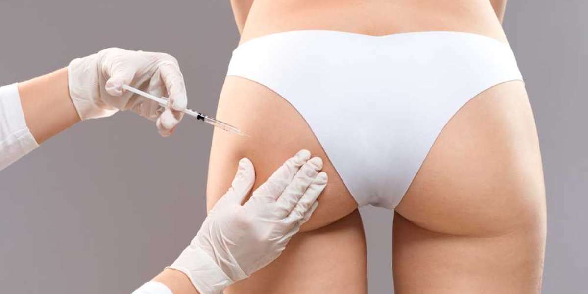 Benefits of Butt Fillers in Dubai for Non Surgical Enhancement