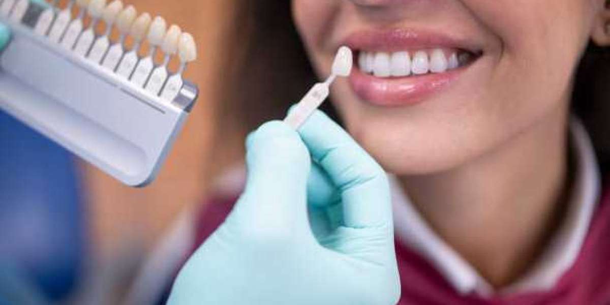 Dental implants in Antalya Upgrade Your Smile with Modern Dentistry