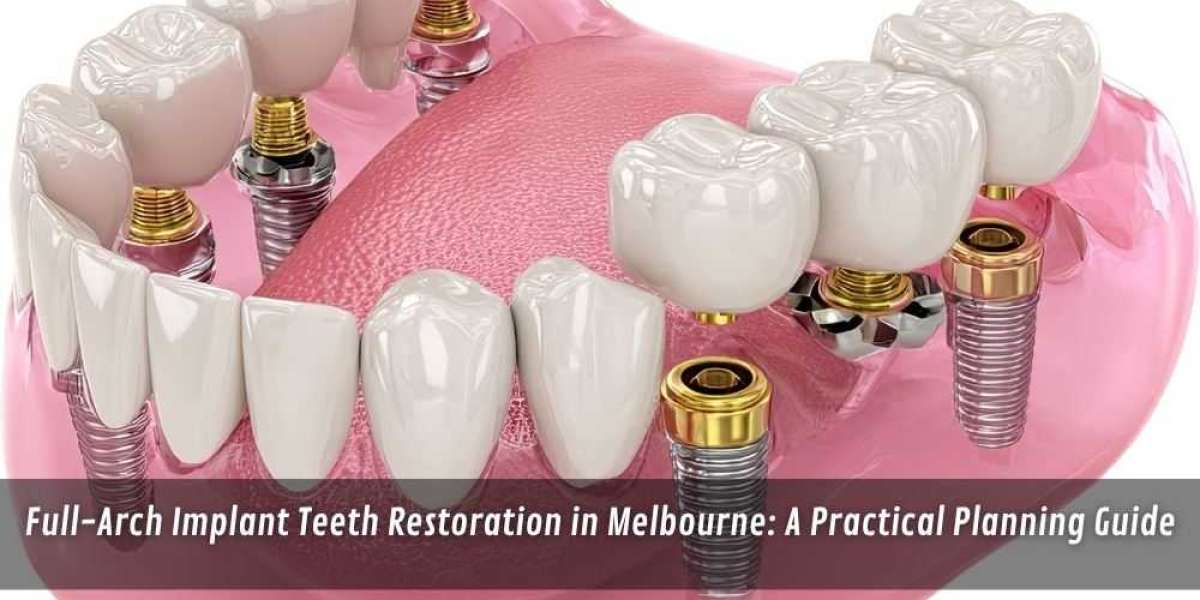 Full-Arch Implant Teeth Restoration in Melbourne: A Practical Planning Guide