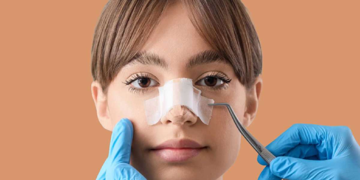 How Does the Best Septoplasty Surgeon in Dubai Fix Deviation?