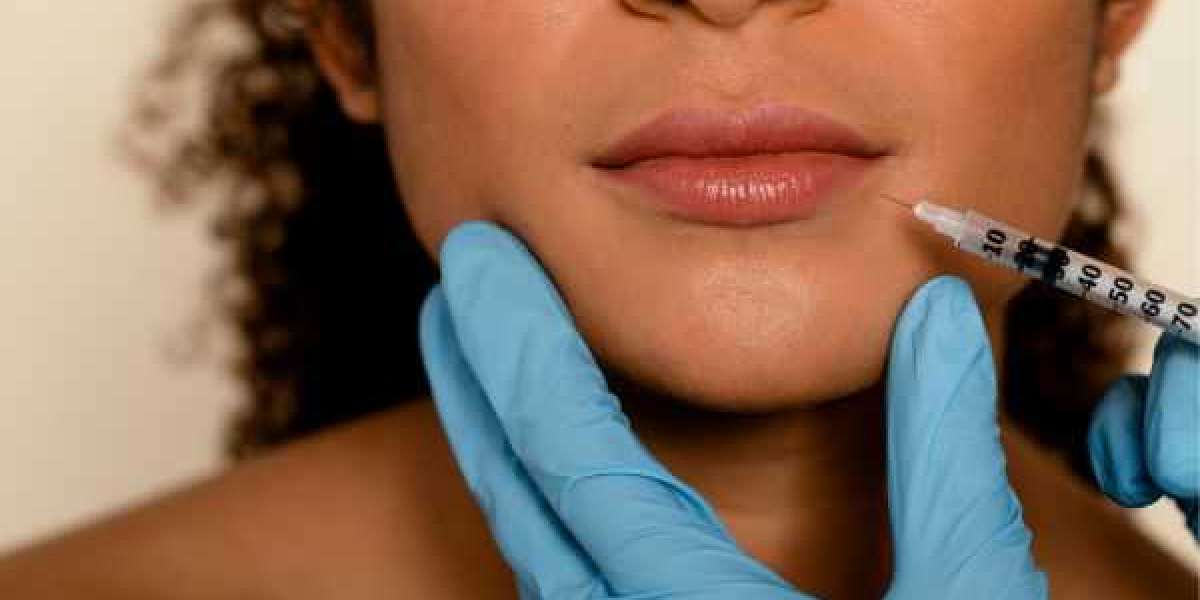 Dermal Fillers in Islamabad: Everything You Need to Know