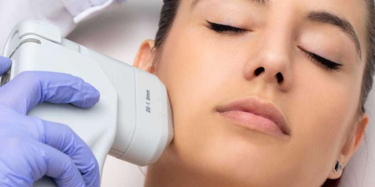 HIFU Treatment in Islamabad: Before & After Expectations