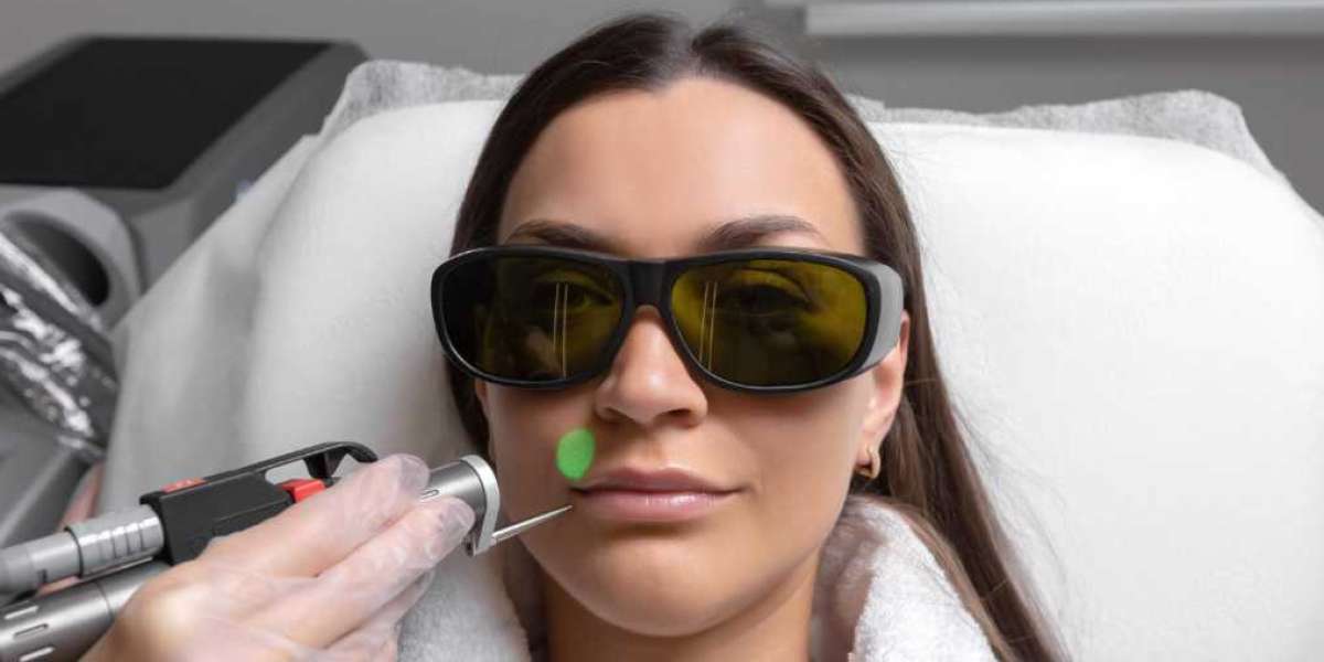 CO2 Laser in Manchester – Deep Skin Resurfacing for Lasting Results