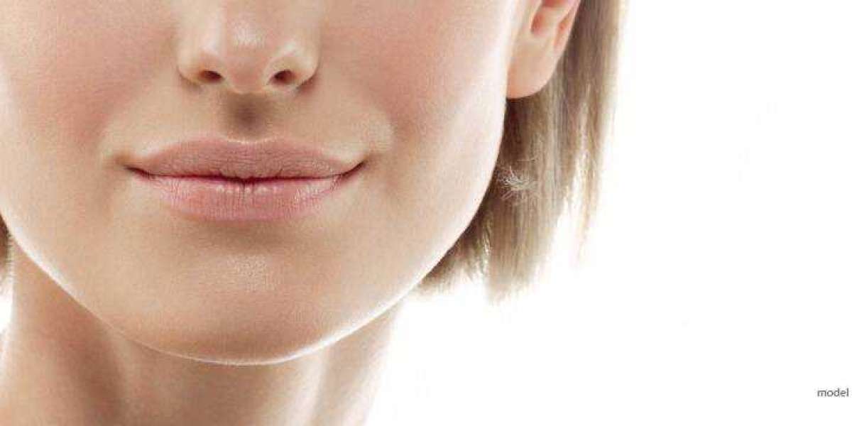 Dermal Fillers for Marionette Lines: What to Know
