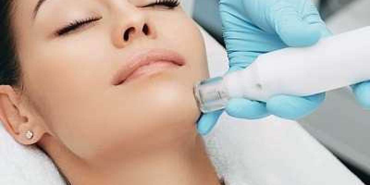 Mesotherapy for Face & Skin in Islamabad: Complete Expert Guide to Mesotherapy Treatment at Enfield Royal Clinic
