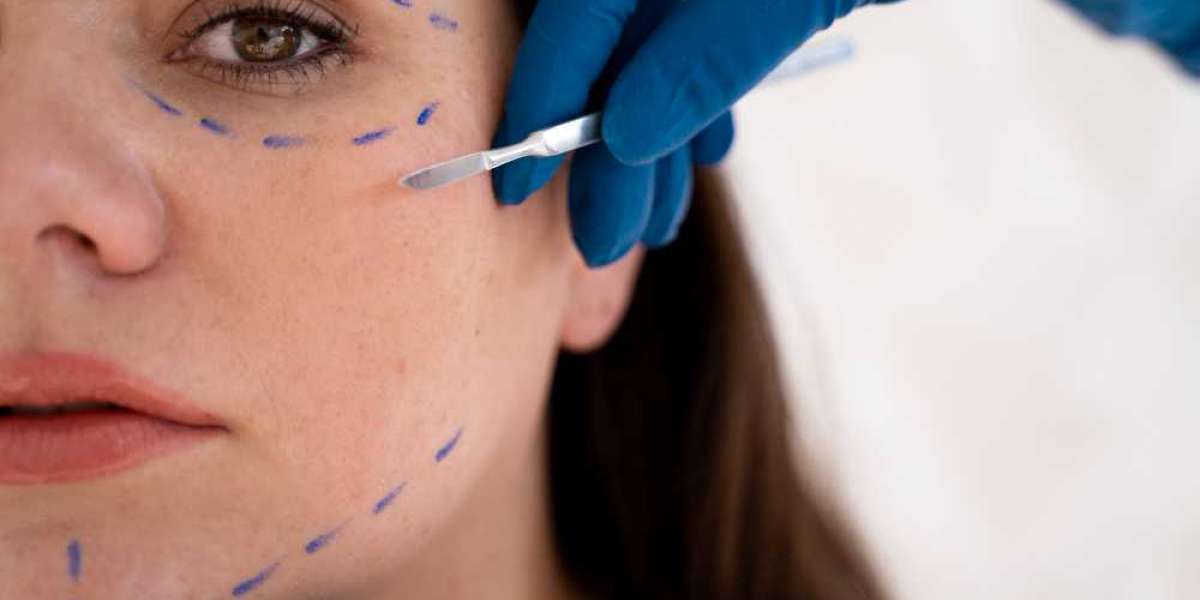 Glabellar Lines Pipeline: Global Trends and Emerging Treatments