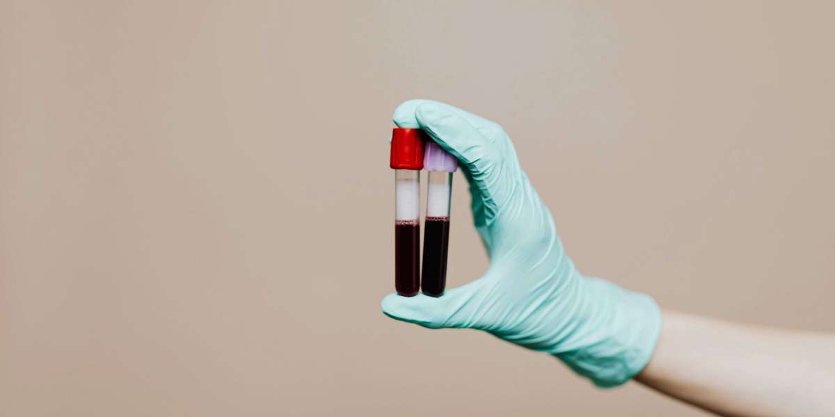 Hepatitis B Test in Dubai Window Period and Retesting Guide
