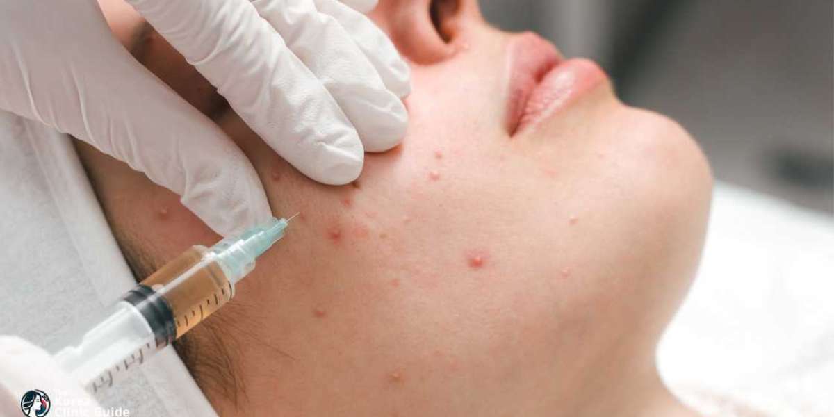 Understanding the Science Behind Stem Cell Therapy