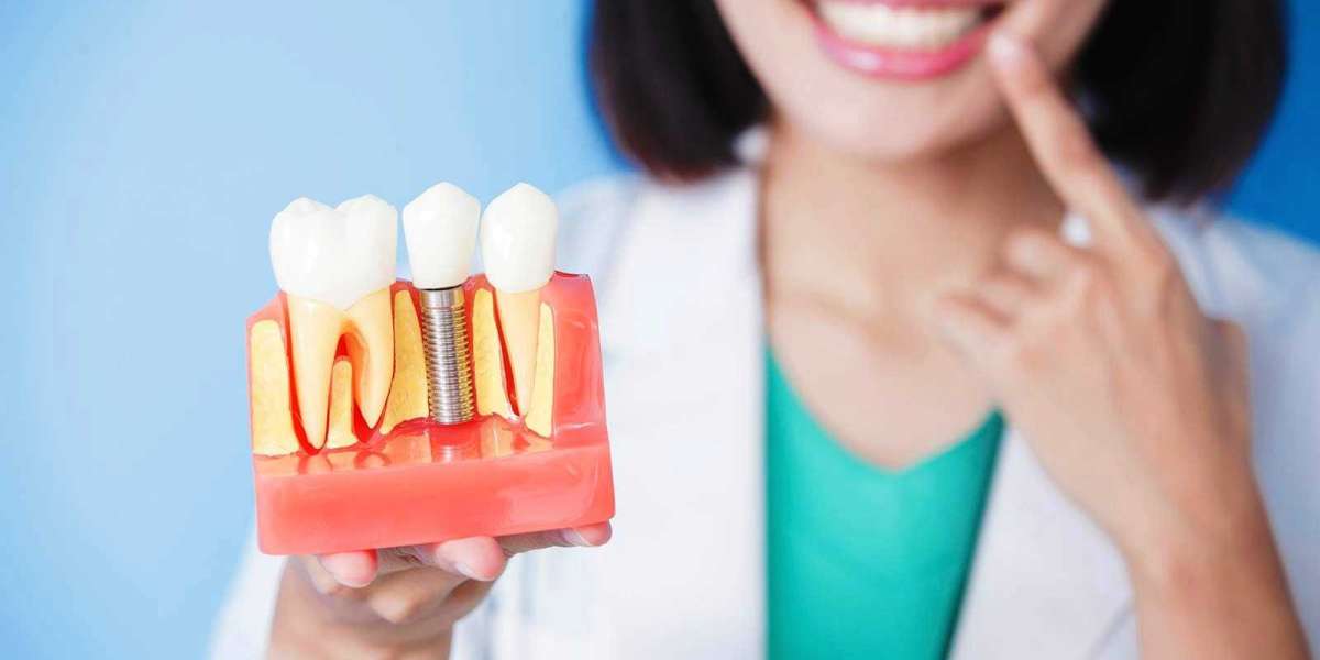 Dental Implant Cost In Dubai vs Other Countries