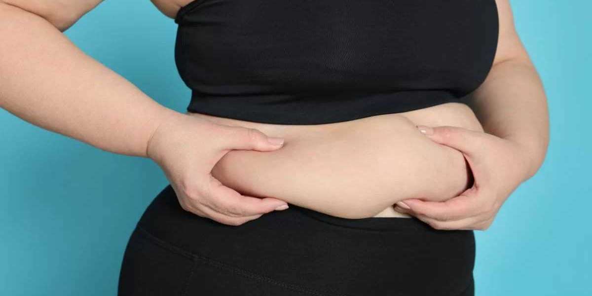 Bariatric Surgery in Islamabad – Complete Guide