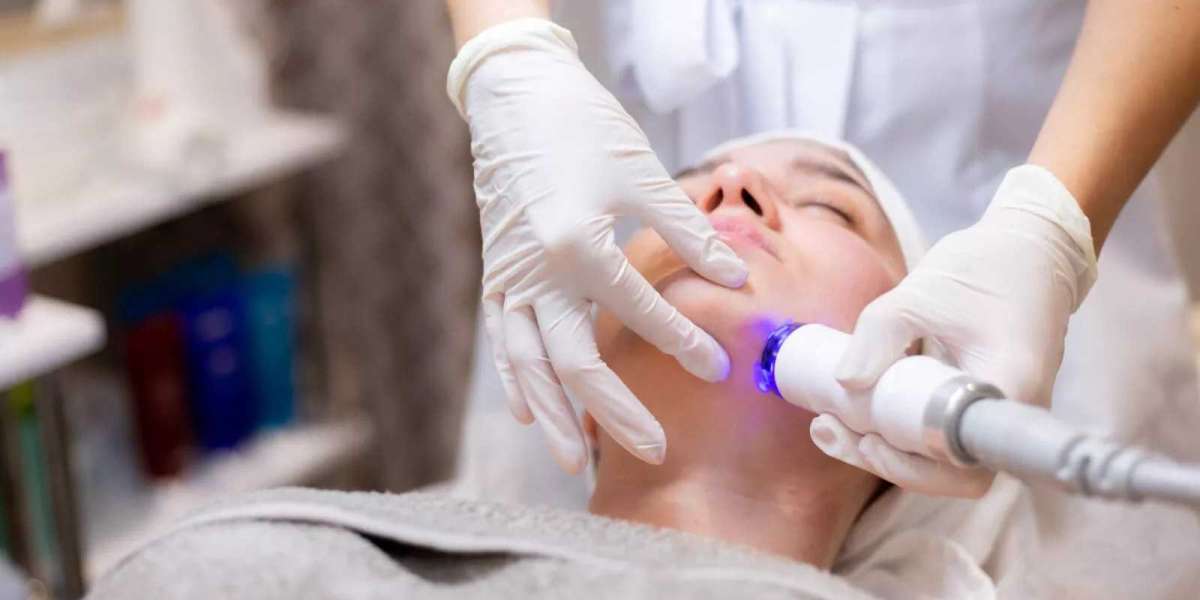Laser Treatment vs Traditional Skincare: What’s More Effective?