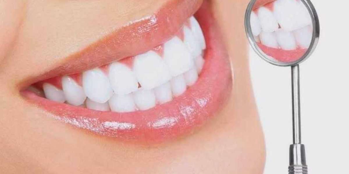 تنظيف وتلميع الأسنان