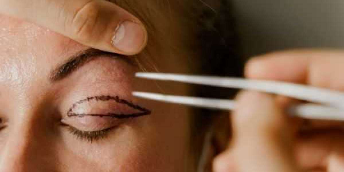 How to Maintain Results After Blepharoplasty in Islamabad