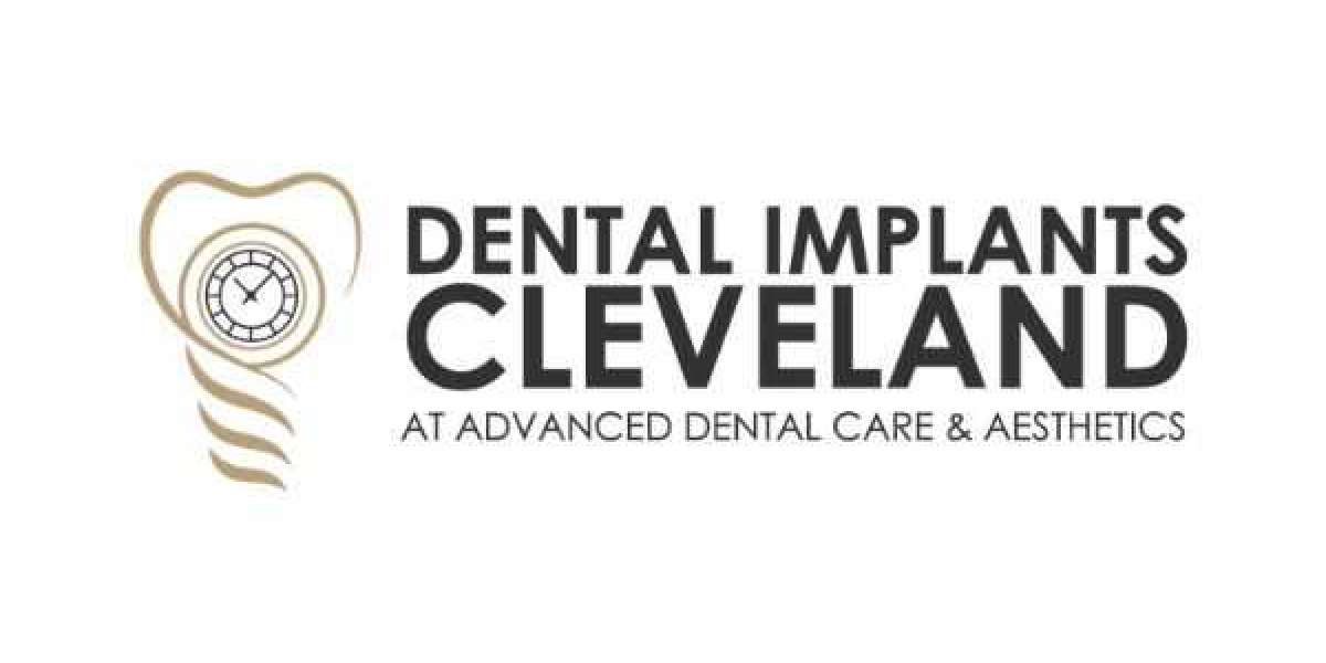 Full Mouth Dental Implants Cleveland OH by Dental Implants Cleveland