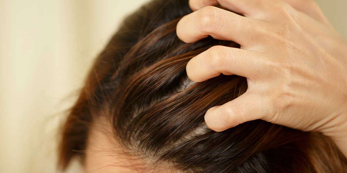 Best Anti-Dandruff and Hair Fall Control Shampoo for Healthy Hair