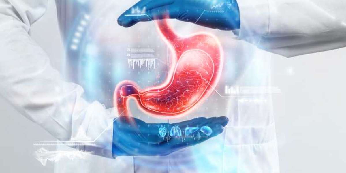 Understanding Heartburn: Why It Happens and How to Treat It