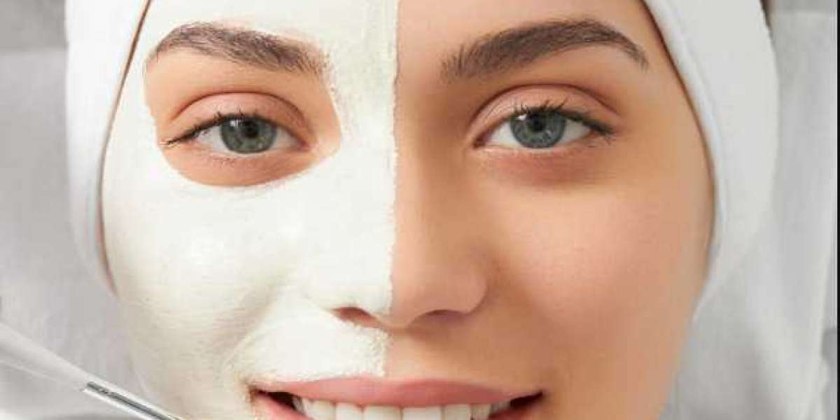 How Chemical Peels Support the Growth of Modern Beauty Businesses