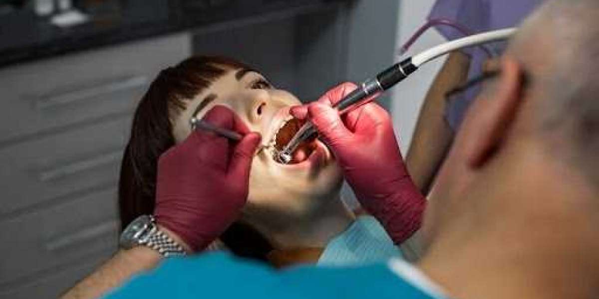 Teeth Filling Composite Charlotte, NC: Complete Treatment Guide